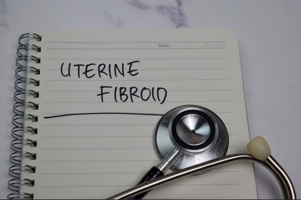 Fibromi rimedi naturali e studi scientifici